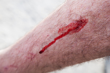 男性腿上的血迹 受伤 意外图片