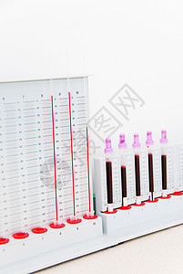 用于验血的实验室收费图片