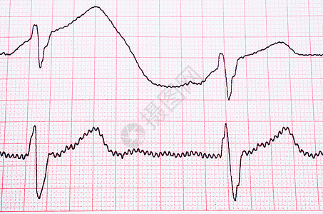 心电组药品医生心脏病失败专家医疗图表测试背景图片