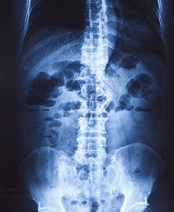 骨盆和脊柱的X光x射线股骨手术射线测试诊所女性科学创伤疾病图片