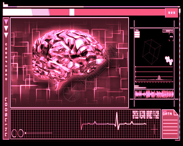 粉红脑接口技术图片