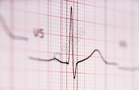 ECG 图形图科学补给品药品状况专家实验室测量卫生疾病阴谋图片