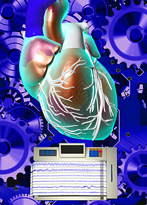 人类心脏模型车轮治疗主动脉器官活动技术电气痕迹工作状况图片