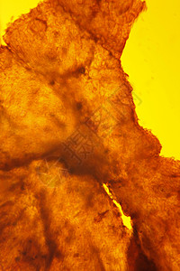 皮肤沙卡照片科学卵泡吞噬细胞细菌显微镜显微插头图片
