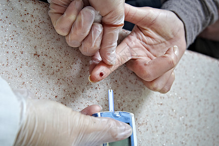 甘糖血层血液测试医疗器械测试血液考试样本医学焦点皮肤选择性药品图片