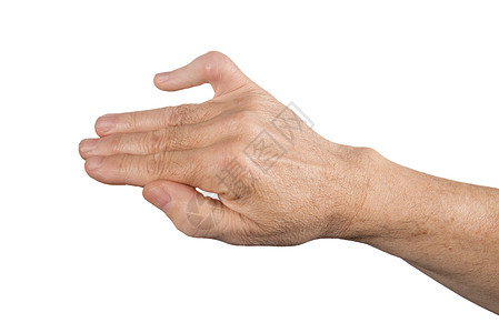 折断手指伤害医疗保险手术外科肌腱医疗保健护理残疾卫生图片