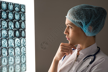 医生看X光片医院身体放射科疾病诊断检查女孩儿科蓝色女性图片