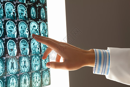 检查医生的手放射科监视器照相健康老年射线药品保健卫生测试图片