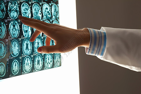 检查医生的手放射科男人照相测试诊断医师诊所癌症药品监视器图片