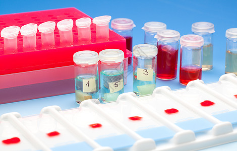 进行血样采集 用于对蓝色的显微镜和活性组织样本癌症测试背景医疗诊断病理玻璃托盘化学图片