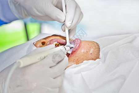 预防牙科工具牙齿诊所医生空腔药品口腔科工作病人矫正图片