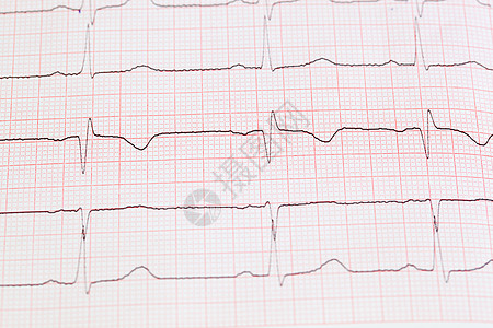 心电图时间海浪脉冲复律实验身体科学脑电图频率程序图片