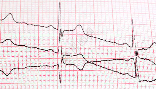 心电图电脑动脉思维死亡梗死勘探实验科学示波器余弦图片