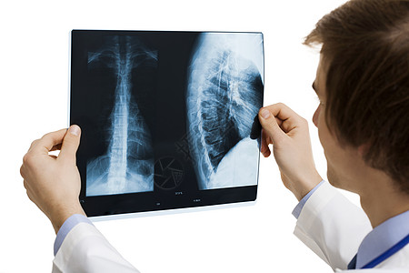医生分析RX医院专家白色柱子脊柱x射线学生男性实验室职业图片
