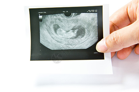 12周婴儿超声波技术扫描女士生活女性父亲药品怀孕考试胎儿图片