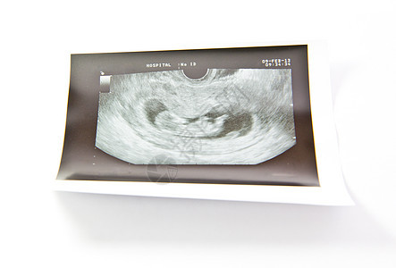 12周婴儿超声波女士医院怀孕诊断胎儿药品技术女性声呐扫描图片
