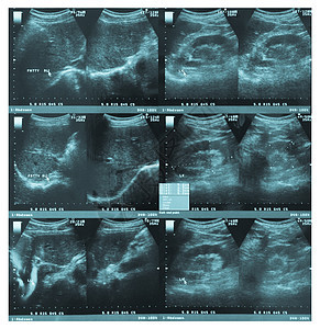 腹部超声波摄影图图片