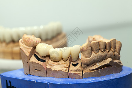 牙科仓库中的聚丙酸牙板板实验室牙医生产修复学口腔产品技术员犬类假肢宏观图片