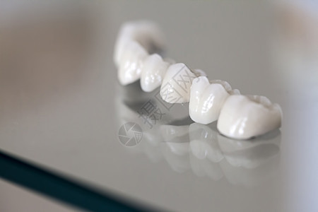 牙科仓库中的聚丙酸牙板板产品修复学口腔镜子生产技术实验室临床陶瓷金属图片