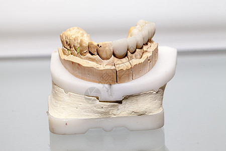 牙科仓库中的聚丙酸牙板板修复学宏观金属口腔药品牙医犬类临床科学制品图片