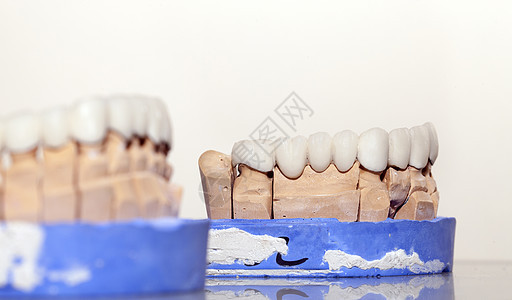 牙科仓库中的聚丙酸牙板板口服牙医犬类口腔卫生金属科学技术假肢临床图片