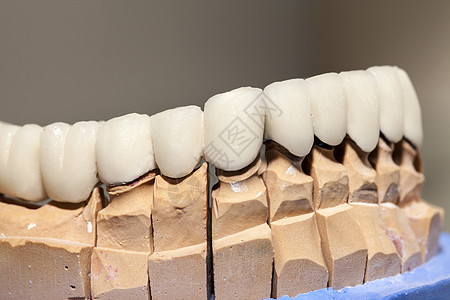 牙科仓库中的聚丙酸牙板板生产产品卫生制品假肢技术科学镜子药品犬类图片