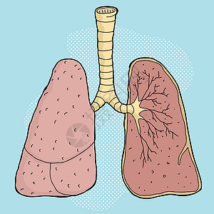 肺炎卡通图片