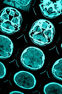 头骨CT和MRI关心医院测试x射线电影x光手术考试诊断诊所图片