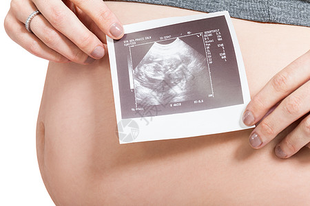 显示产前超声波检查的孕妇产科生育力产妇考试母亲腹部子宫扫描医疗胎儿图片