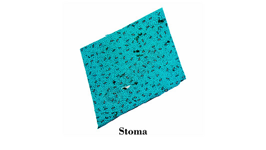 Stoma 显微镜图片