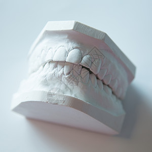 白色背景上的人类下巴的Gypsum模型保健牙医技术解剖学假肢药品口腔科投掷牙科铸件图片