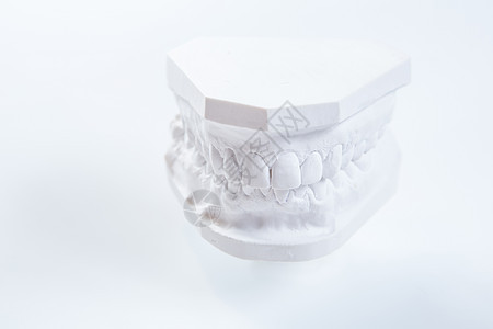 白色背景上的人类下巴的Gypsum模型保健实验室口服投掷牙医桥梁盘子矫正假牙牙齿图片