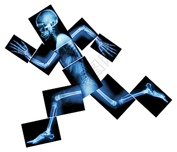 马拉松 人体骨骼跑 全身X光 头 颈 肩 臂 肘 前臂 手 手指 关节 胸部 腹部 背部 骨盆 臀部 大腿 腿 膝 脚 脚跟医院图片