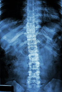 正常人的胸椎脊椎卫生保健药品解剖学骨科临床科学腰椎电影椎骨图片