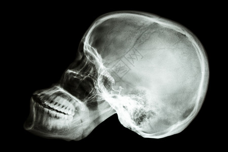 亚述人头骨泰国人颅骨保健放射科身体电影药品脖子死亡解剖学男人图片