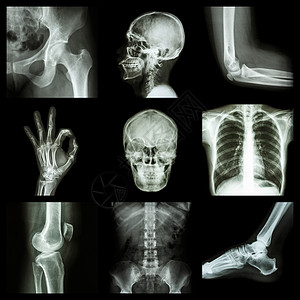 人体X射线部分科学男人膝盖骨科扫描外科病人卫生射线手术图片