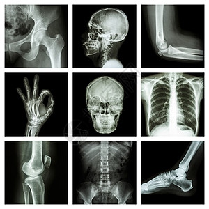 人体X射线部分画廊病人弯头射线解剖学药品x光编译扫描目录图片