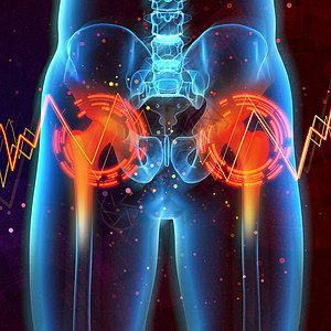 3d 医学证明 一个疼痛的腿骨骨骼骨盆胸部八角膝盖下颌髌骨坐骨肩膀医疗图片