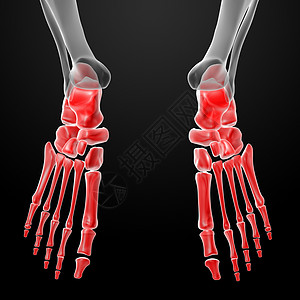 3d 使人脚X射线疾病外科科学骨骼病人高跟鞋辐射医院卫生药品图片