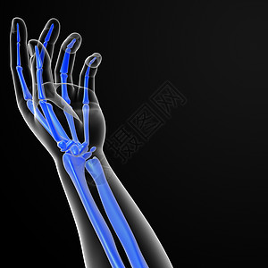 手掌考试放射性手臂药品手指放射科技术棕榈射线身体图片