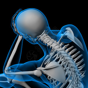 3d 让一个坐着的红色骨骼变成红色外科考试手术医生身体躯干射线成人骨干风湿病图片