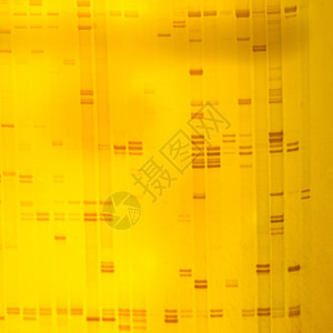 植物DNA指纹医疗生物学电泳化学细胞保健技术测序实验室遗传图片