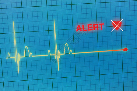 显示器上的心脏比心动图要强技术卫生情况电脑警告逮捕速度蓝色展示死亡图片