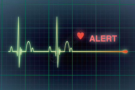 显示器上的心脏比心动图要强攻击屏幕诊断卫生蓝色心脏病展示逮捕警告心电图图片