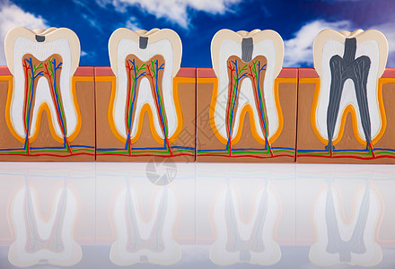 人牙结构 亮亮多彩的音调概念衰变牙龈树脂空腔牙科咀嚼假肢口腔科感染指甲图片
