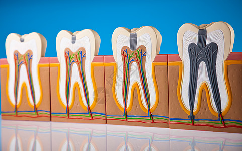 人牙结构 亮亮多彩的音调概念动脉牙龈牙医感染指甲衰变磨牙空腔假肢神经图片