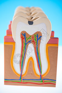 牙齿 亮亮多彩的音调概念牌匾空腔咀嚼卫生衰变感染神经口腔科磨牙树脂图片