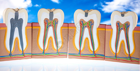 牙齿解剖学 明亮多彩的音调概念磨牙口腔科牙科身体空腔打扫神经牙龈衰变树脂图片