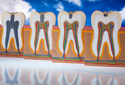 牙齿解剖学 明亮多彩的音调概念磨牙假肢疼痛咀嚼身体牙科动脉牙龈牙医树脂图片