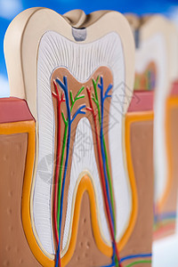 牙齿解剖学 明亮多彩的音调概念牌匾树脂磨牙身体牙医咀嚼假肢空腔衰变神经图片